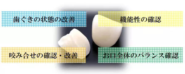 シミュレーション