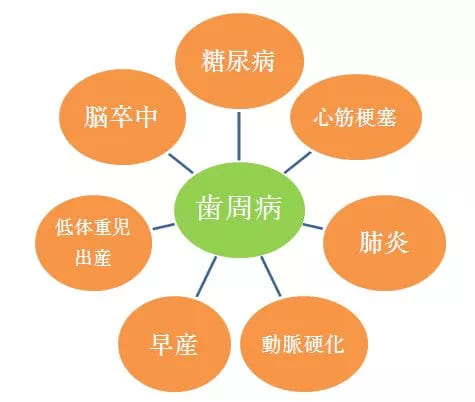 歯周病と全身疾患の関係性