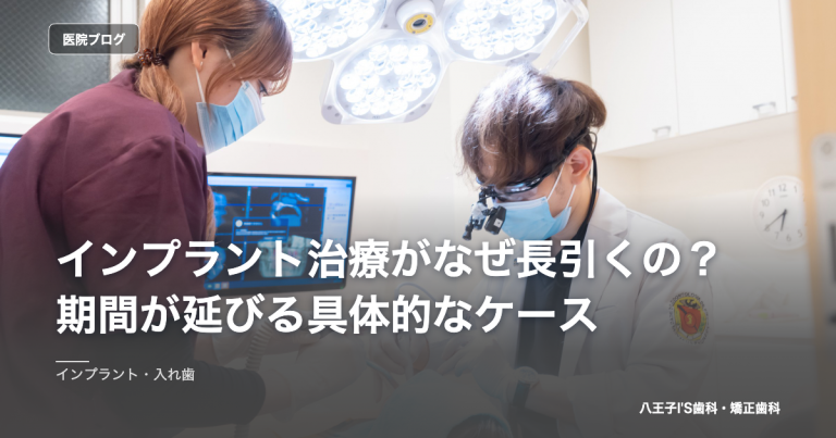 インプラント治療がなぜ長引くの？期間が延びる具体的なケース のアイキャッチ画像