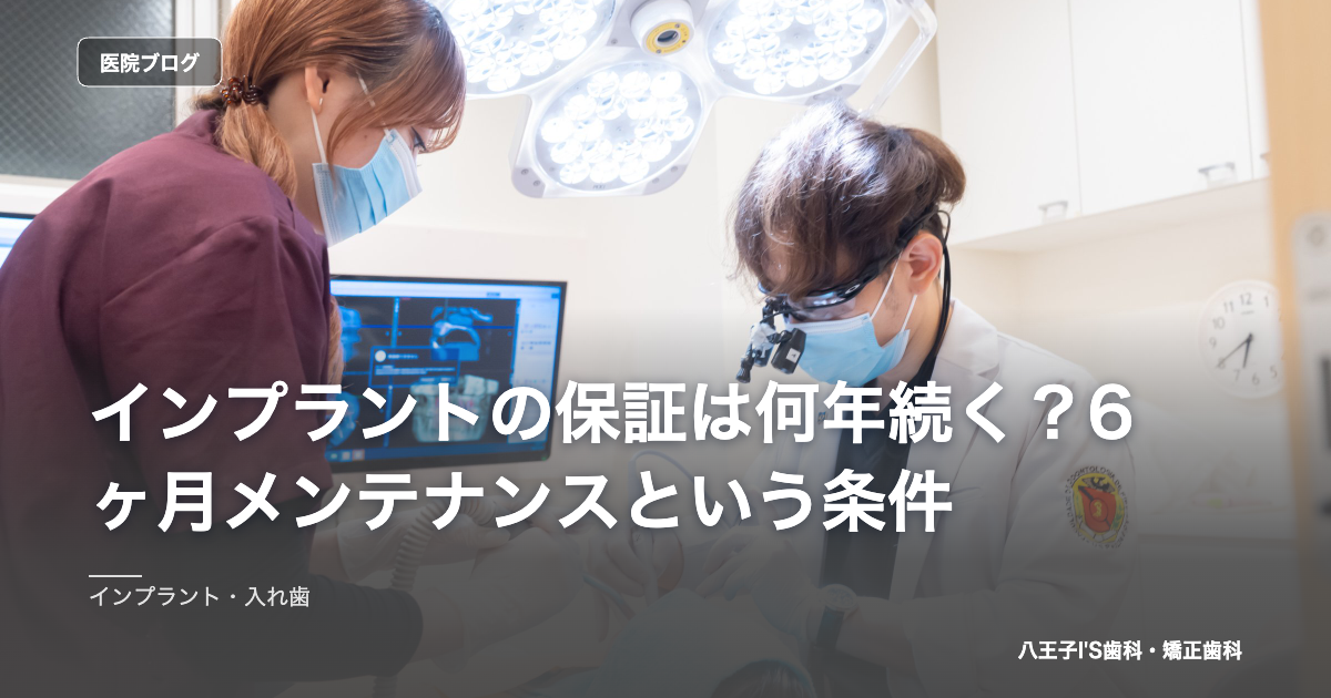 インプラントの保証は何年続く？6ヶ月メンテナンスという条件 のアイキャッチ画像
