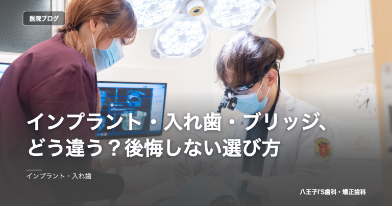 インプラント・入れ歯・ブリッジ、どう違う？後悔しない選び方 のアイキャッチ画像